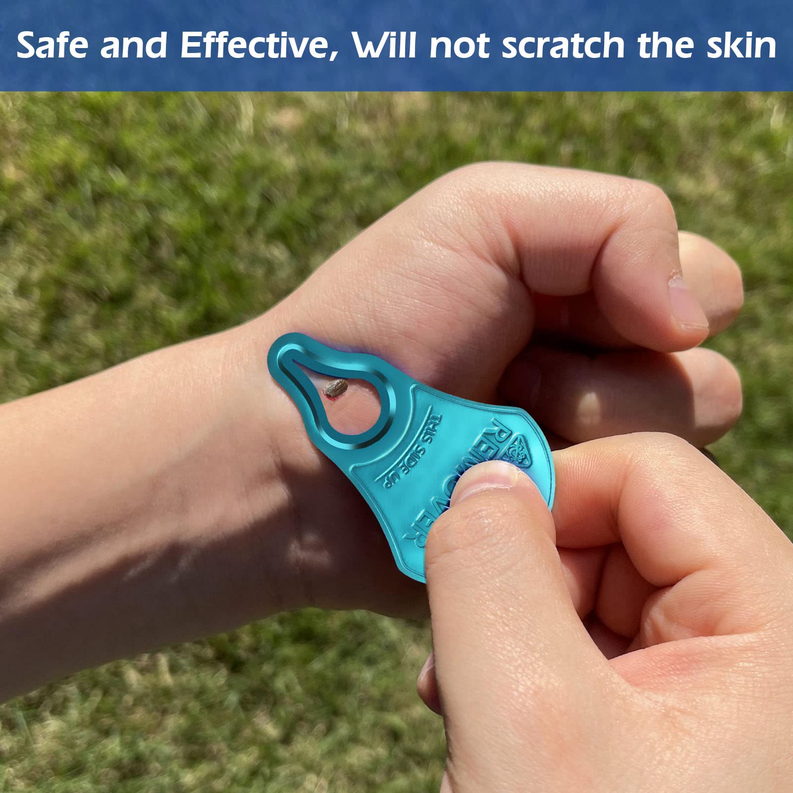 Anblak 3 Pack Tick Remover Tool - Portable, Pain-Free Removal for Pets & Humans, Model TRA