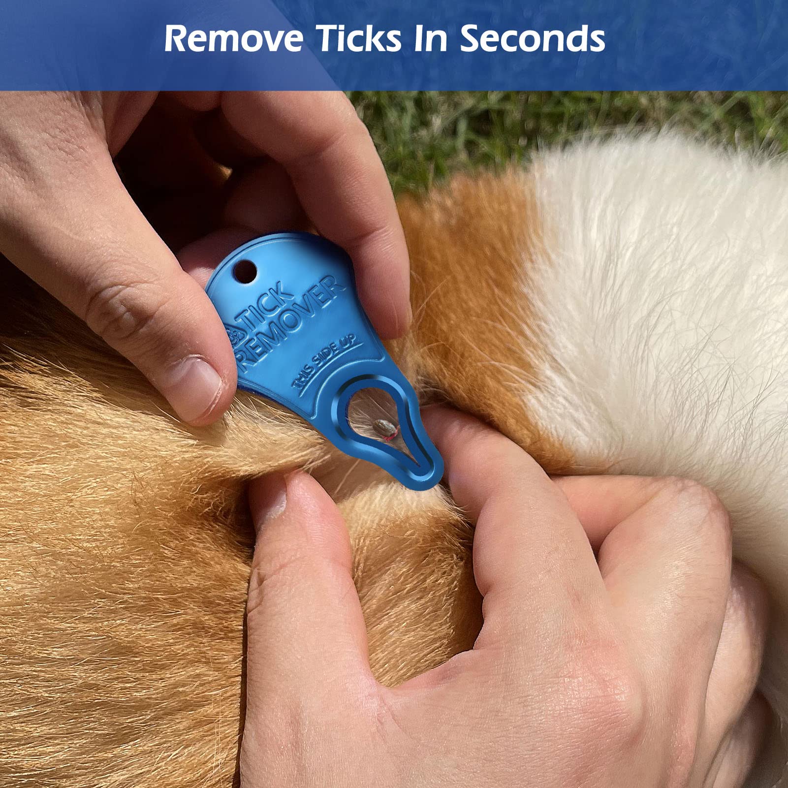 Anblak 3 Pack Tick Remover Tool - Portable, Pain-Free Removal for Pets & Humans, Model TRA