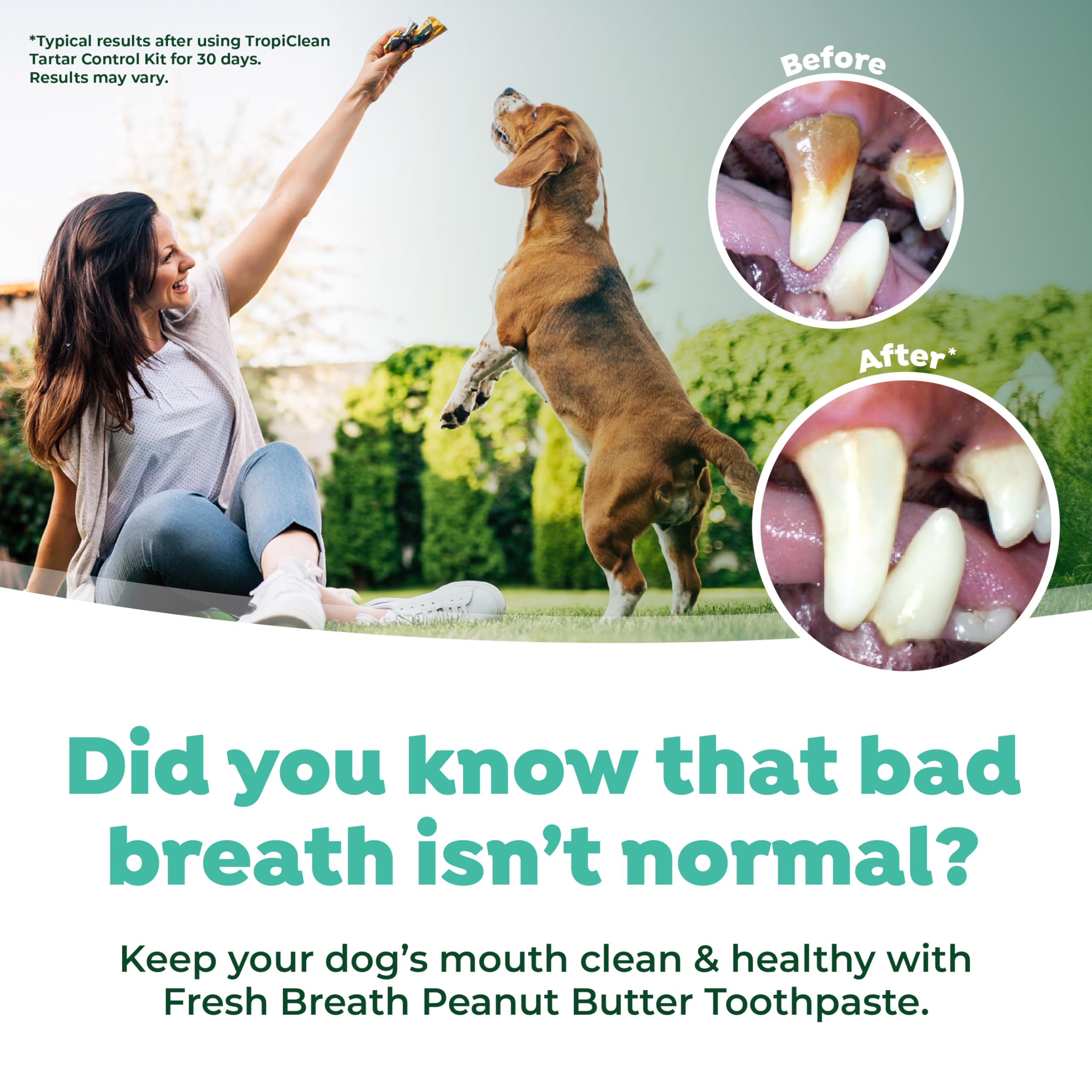 TropiClean Fresh Breath Oral Care Kit - Soft Bristle Finger Toothbrush - Dog Tooth Brushing Kit - Peanut Butter and Honey Flavor