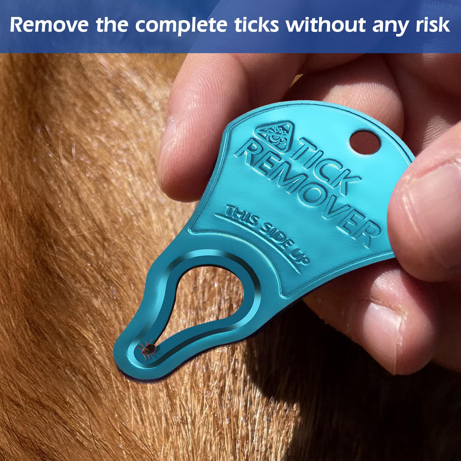 Anblak 3 Pack Tick Remover Tool - Portable, Pain-Free Removal for Pets & Humans, Model TRA